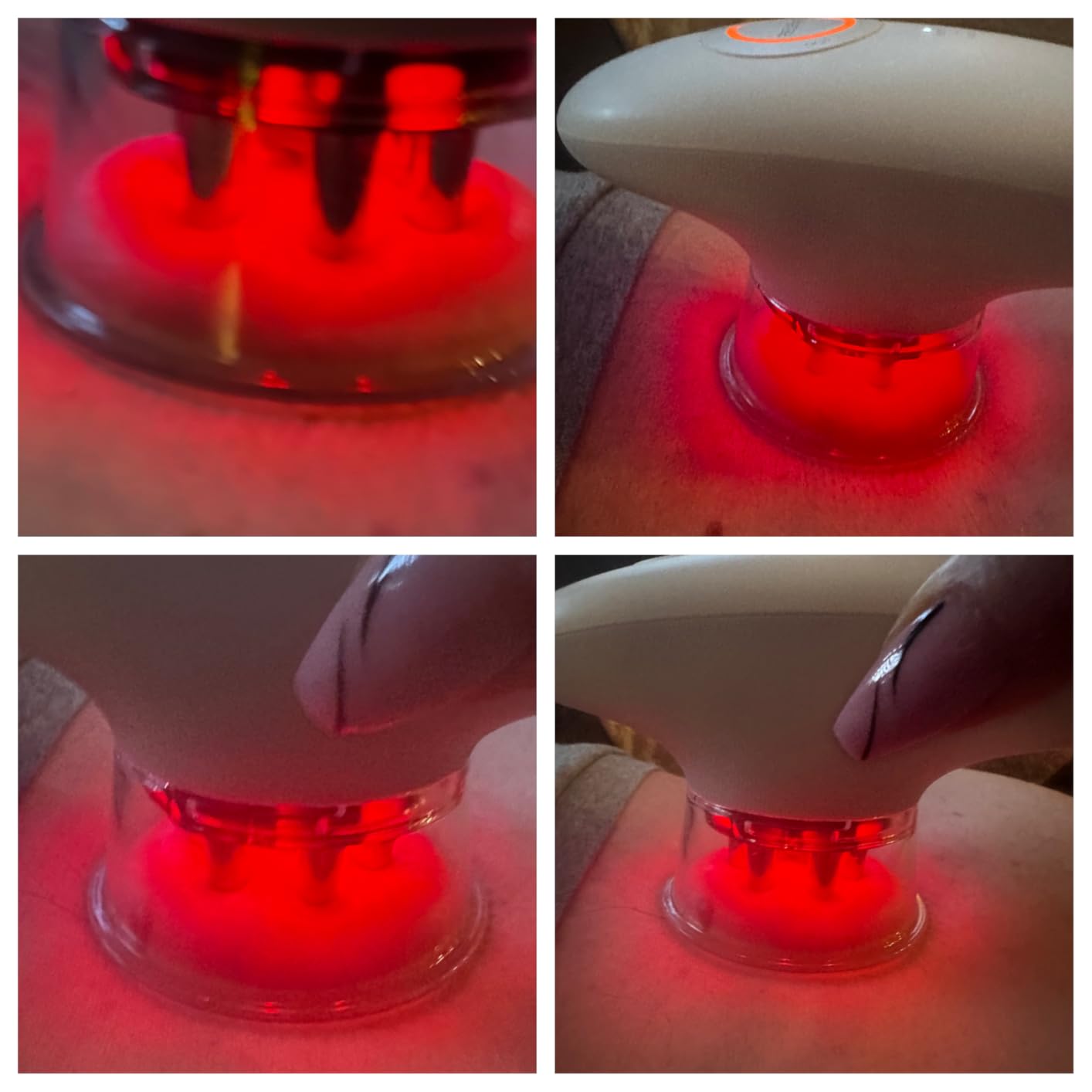 SCULPIFLEX – Original 3-in-1 Body Sculpting Machine for Firmer-Looking Skin – Lymphatic Drainage Massager & Cellulite Massage Tool for Stomach, Arms, Legs, and Thighs + 1x Gel customer photo 2