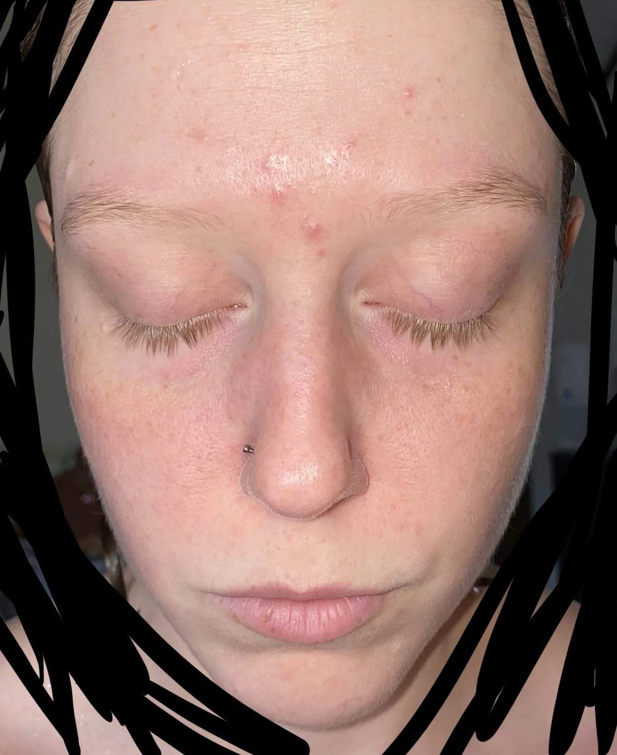 medicube Zero Pore Cleanser customer photo 2